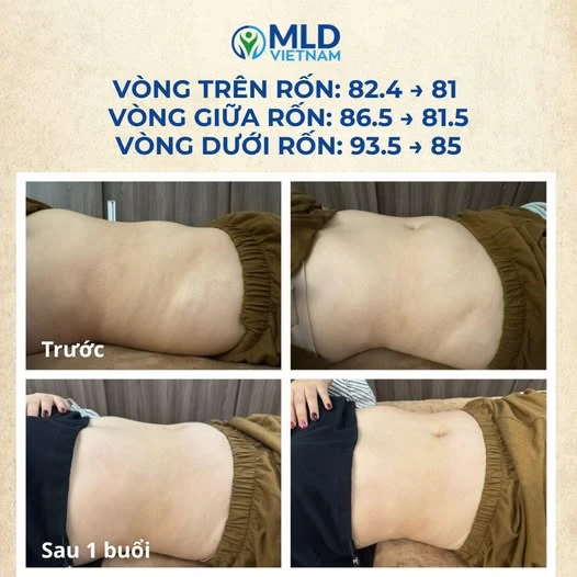 Phụ nữ hiện đại: vì sao nên dẫn lưu bạch huyết đều đặn?